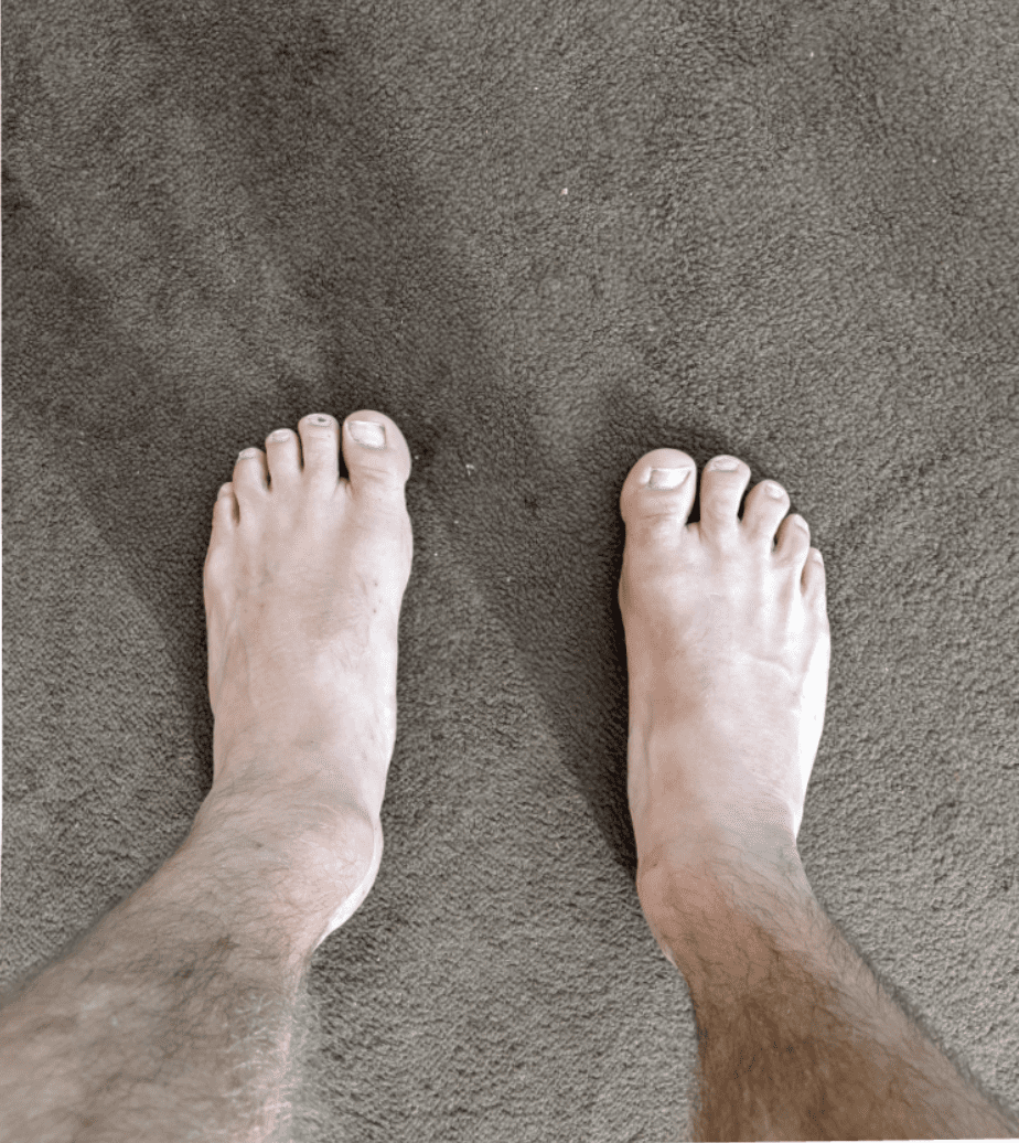 log feet - best barefoot shoe