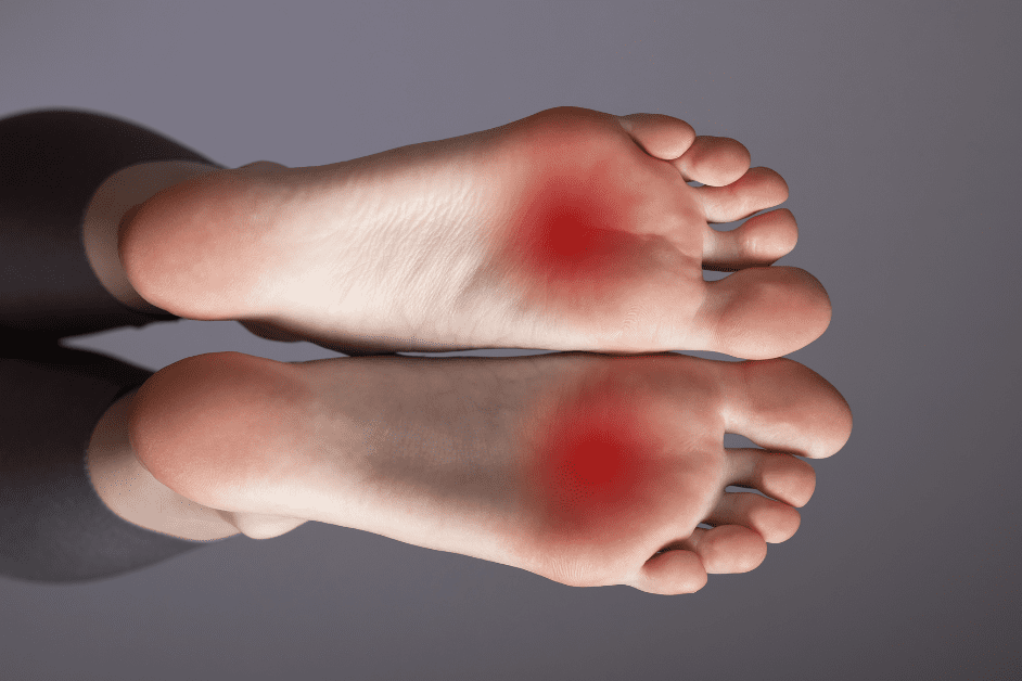 mortons neuroma